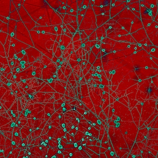 Waar lopen de ondergrondse biowegen? Onderzoekers brengen wereldwijd schimmelnetwerken in kaart